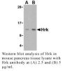 Anti-Human Hrk - 20 µg
