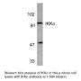 Anti-Human IκB Kinase Alpha (CT-2) (IKKα) - 0.1 mg