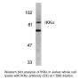 Anti-Human IκB Kinase Alpha (CT-3) (IKKα) - 20 µg