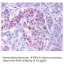 Anti-Human I-Kappa-B Kinase Epsilon (CT) (IKKε) - 20 µg
