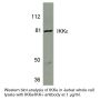 Anti-Human I-Kappa-B Kinase Epsilon (CT) (IKKε) - 20 µg