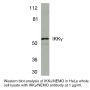Anti-Human I-Kappa-B Kinase Gamma (NT) (IKKγ) - 20 µg