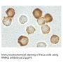 Anti-Human IL-1 Receptor Associated Kinase 2 (CT-2) (IRAK-2) - 20 µg