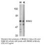 Anti-Human IL-1 Receptor Associated Kinase 2 (CT-2) (IRAK-2) - 20 µg