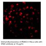 Anti-Human IL-1 Receptor Associated Kinase 2 (CT-1) (IRAK-2) - 20 µg