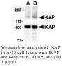 Anti-Human IKK Complex-Associated Protein (IKAP) - 20 µg