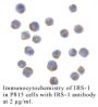 Anti-Human Insulin Receptor Substrate-1 (IRS-1) Antibody - 20 µg
