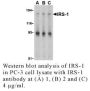Anti-Human Insulin Receptor Substrate-1 (IRS-1) Antibody - 20 µg