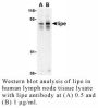Anti-Human Lipe - 20 µg