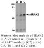 Anti-Mouse IL-1 Receptor Associated Kinase 2 (CT-2) (IRAK2) - 0.1 mg
