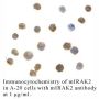 Anti-Mouse IL-1 Receptor Associated Kinase 2 (CT-1) (IRAK2) - 20 µg