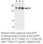 Anti-Human ILPIP (CT) - 20 µg