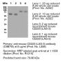 Anti-Mouse CD223 (LAG-3) [C9B7W] – Purified <i>in vivo </i>GOLD™ Functional Grade - 1.0 mg