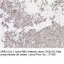 Anti-SARS-CoV-2 Spike RBD (Clone 2165) - HRP - 50 µg