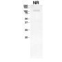 Anti-Human EGFR (Necitumumab) - 1.0 mg