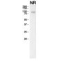 Anti-Human EGFR (Panitumumab) - 100 mg