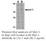 Anti-Human Mcl-1 (CT) - 20 µg