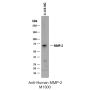 Anti-Human MMP-2 - 100 µg