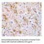 Anti-Human Neurturin - 0.1 mg