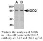 Anti-Human NOD2 (CT) - 0.1 mg