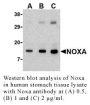 Anti-Human Noxa - 0.1 mg