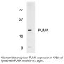Anti-Human p53 Upregulated Modulator of Apoptosis (NT) (PUMA) - 0.1 mg