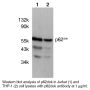 Anti-Human Tyrosine Kinase Substrate p62<sup>dok</sup> (CT) - 0.1 mg