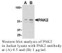 Anti-Human P21-Activated Kinase 2 (CT) (PAK2) - 0.1 mg