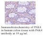 Anti-Human P21-Activated Kinase 4 (PAK4) - 0.1 mg