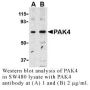 Anti-Human P21-Activated Kinase 4 (PAK4) - 0.1 mg