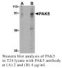 Anti-Human P21-Activated Kinase 5 (PAK5) - 0.1 mg