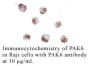 Anti-Human P21-Activated Kinase 6 (PAK6) - 0.1 mg