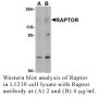 Anti-Human Raptor (NT) - 0.1 mg