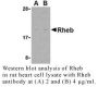 Anti-Human Ras Homolog Enriched in Brain (NT) (Rheb) - 20 µg