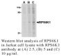 Anti-Human Ribosomal Protein S6 Kinase 1 (RPS6K1) - 0.1 mg