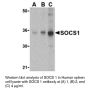 Anti-Human Suppressor of Cytokine Signaling 1 (CT) (SOCS1) - 0.1 mg