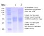 Recombinant SARS-CoV-2, Nucleocapsid (N) Protein