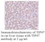Anti-Human Tail-Interacting Protein 47 (NT) (TIP47) - 0.1 mg