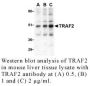 Anti-Human TNF Receptor-Associated Factor 2 (CT) (TRAF2) - 0.1 mg