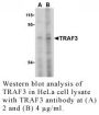 Anti-Human TNF Receptor-Associated Factor 3 (CT-2) (TRAF3) - 0.1 mg
