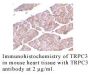 Anti-Human Transient Receptor Potential Channel 3 (CT) (TRPC3) - 0.1 mg