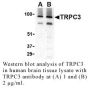 Anti-Human Transient Receptor Potential Channel 3 (CT) (TRPC3) - 0.1 mg