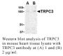 Anti-Human Transient Receptor Potential Channel 3 (NT) (TRPC3) - 0.1 mg