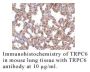 Anti-Human Transient Receptor Potential Channel 6 (CT) (TRPC6) - 0.1 mg