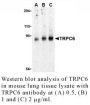 Anti-Human Transient Receptor Potential Channel 6 (CT) (TRPC6) - 0.1 mg