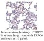 Anti-Human Transient Receptor Potential Channel 6 (NT) (TRPC6) - 0.1 mg