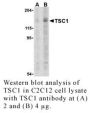 Anti-Human Tuberous Sclerosis Complex 1 (CT) (TSC1) - 20 µg