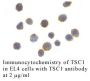 Anti-Human Tuberous Sclerosis Complex 1 (Intermediate Domain) (T - 0.1 mg