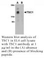 Anti-Human Tuberous Sclerosis Complex 1 (Intermediate Domain) (T - 0.1 mg