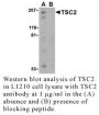 Anti-Human Tuberous Sclerosis Complex 2 (CT) (TSC2) - 20 µg